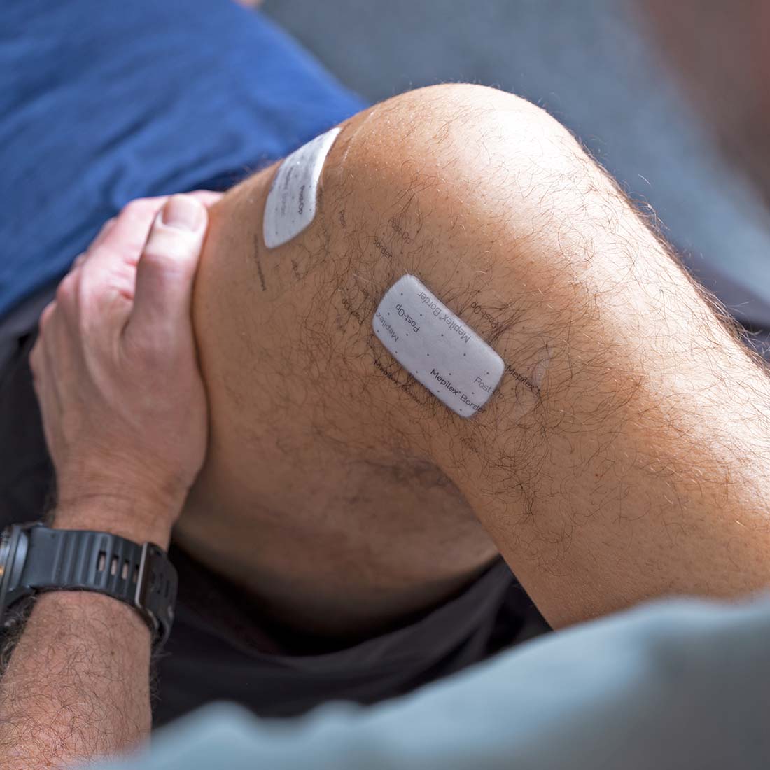 Curativo Pós-operatório Mepilex Border Post-Op - Imagem 6