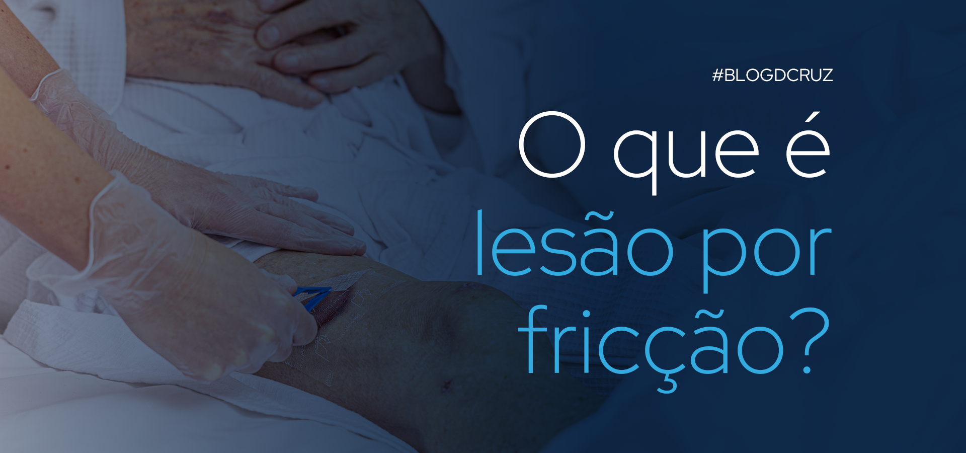 Lesão por Fricção